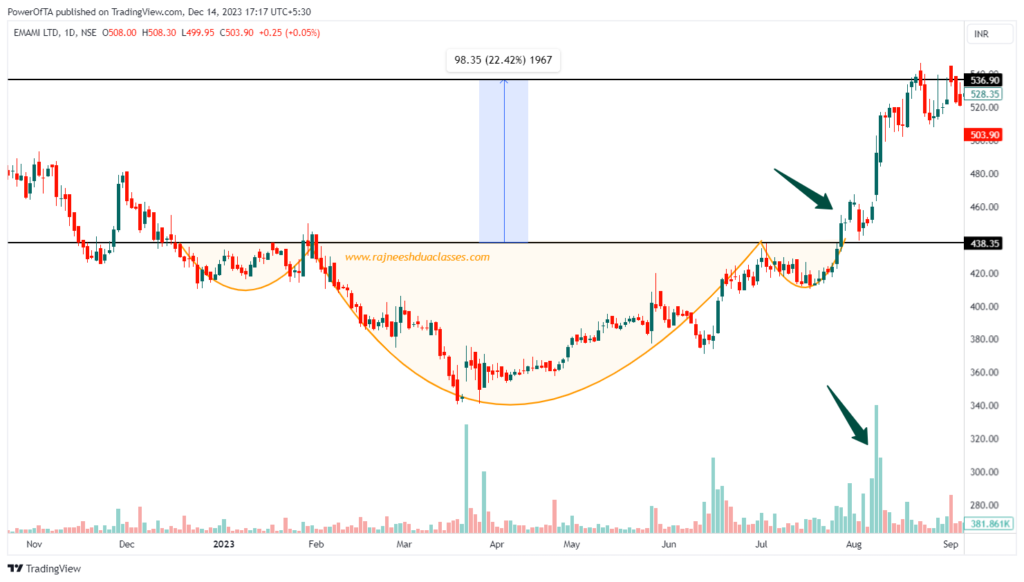 Inverted Head and Shoulders Pattern: Meaning, Features & Examples